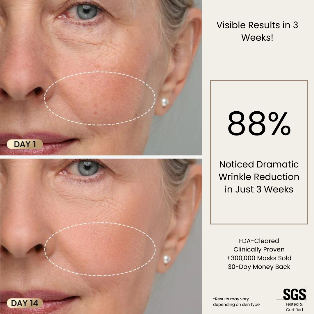 Auralè Spectra LED Mask