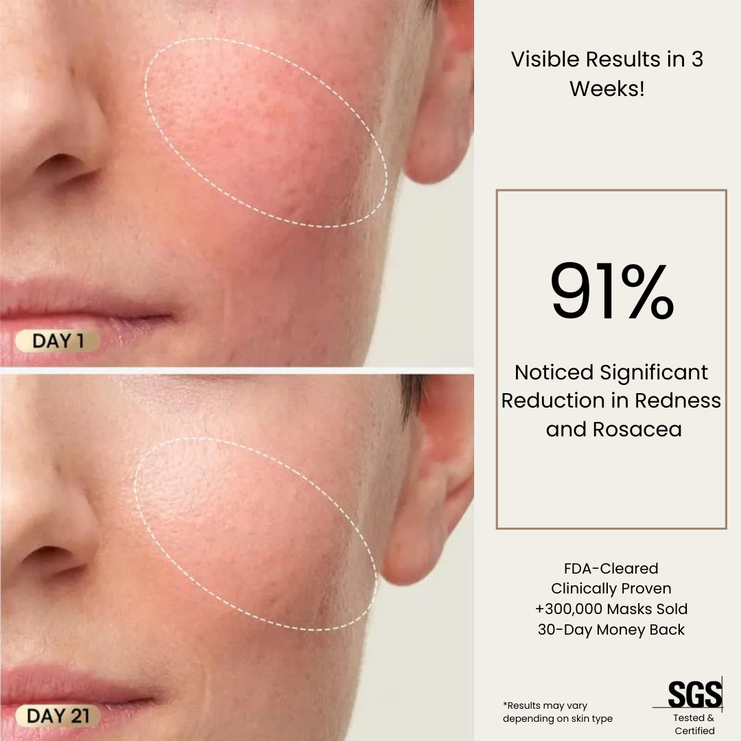 Auralè Spectra LED Mask