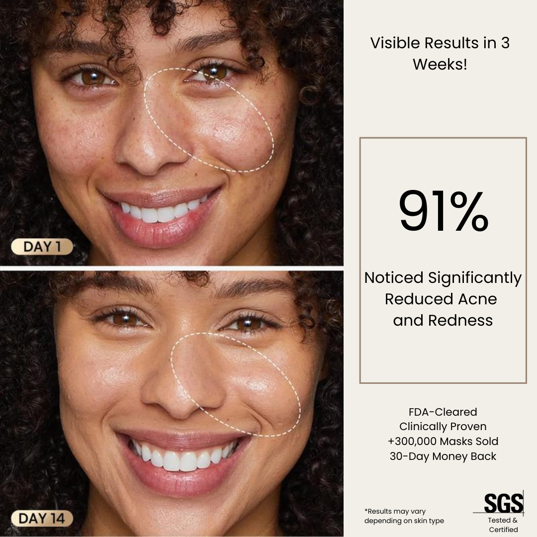 Auralè Spectra LED Mask